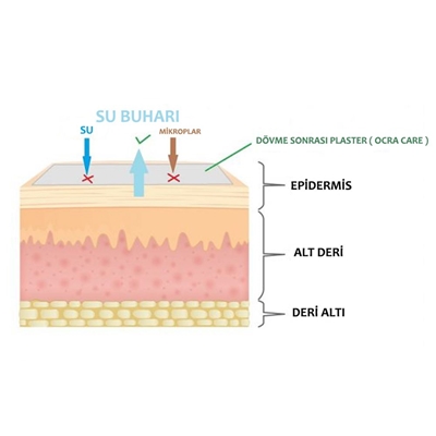 Octacare Dövme Sonrası Plaster 10 m * 15 cm